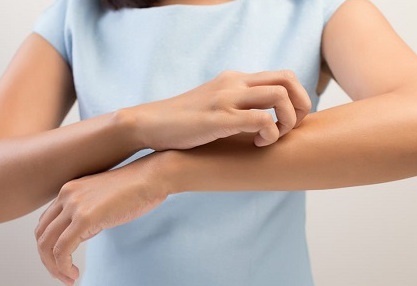 Dealing with Eczema at the Source: Autoimmunity