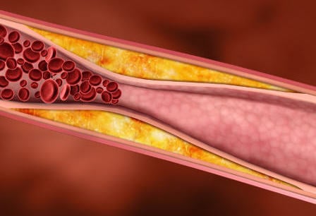 Cholesterol & Aggression
