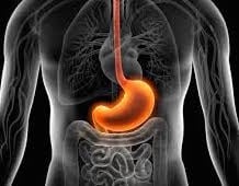 Acid Reflux The Diet and Beyond