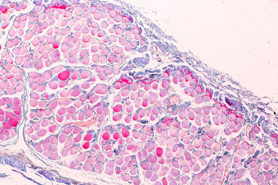 Resveratrol and the Immunology of Senescent Cells