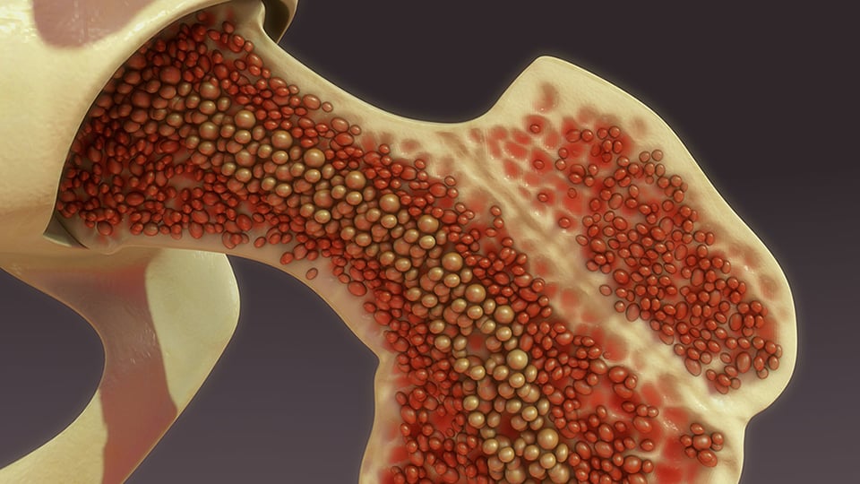 Exploring the Clinical Potential of Berberine in Musculoskeletal Disorders
