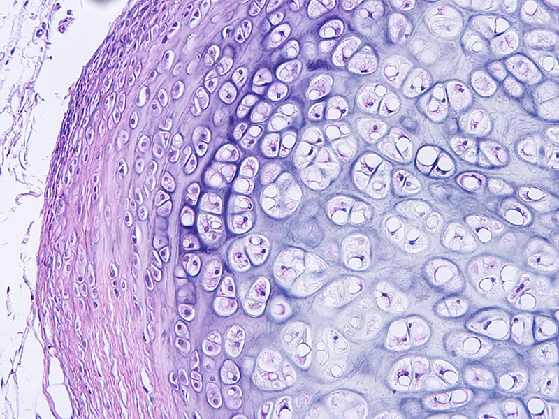 Can Supplemental Collagen Repair Cartilage?