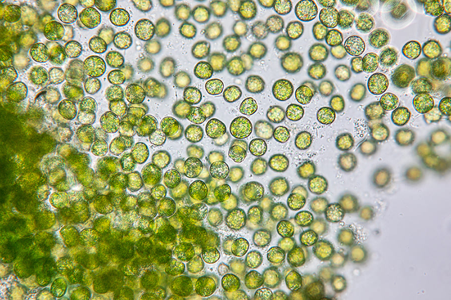Detox and Beyond: The Broad Health-supportive Roles of Chlorella