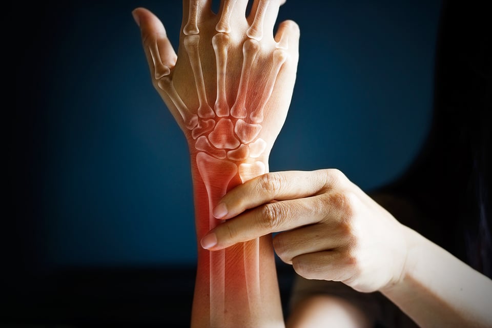 Bone-Muscle Crosstalk: Exploring New Insights for Addressing Sarco-osteoporosis