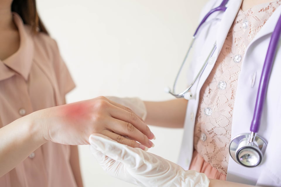 Can Psoriasis Increase Risk of Osteoporosis and Fractures?