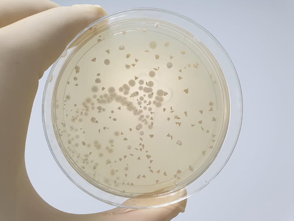 The Latest on Saccharomyces boulardii and GI Health