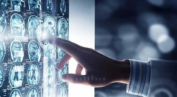 Brain Awareness Month