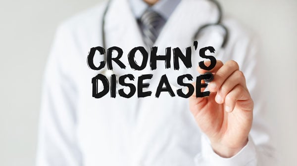 Discovery of a Critical Link between Crohn’s and the Gut Microbiome