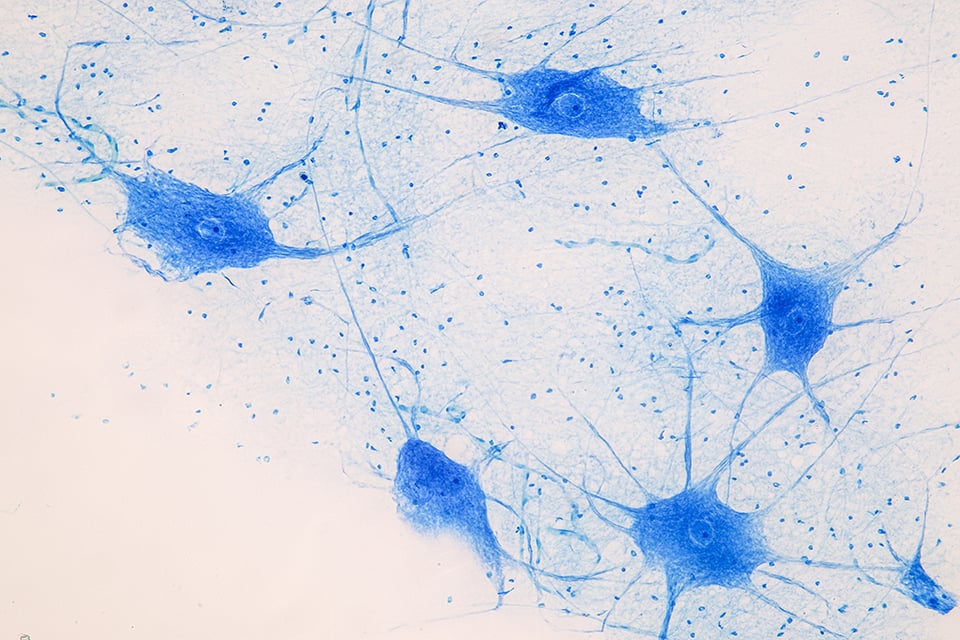 Recent Review Investigates Potential Link Between Cognitive Health and NAD+ Precursor Supplementation