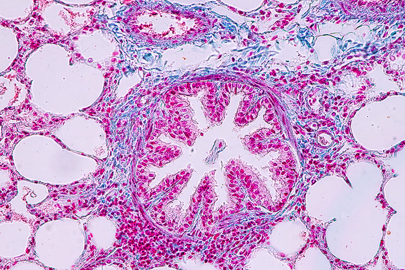 Lung Function and the Inflammatory Response