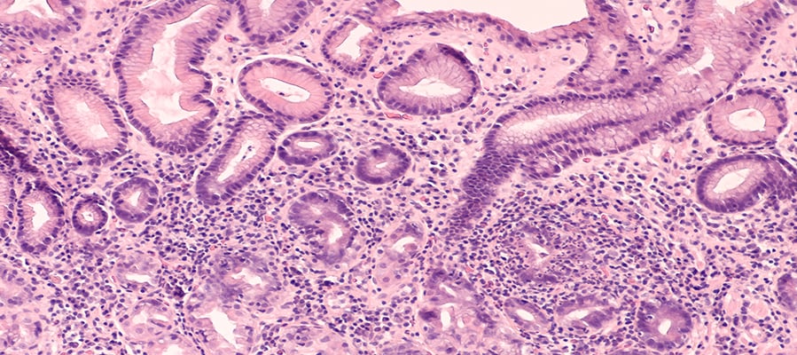 New Study Connects Certain Mood Disorders with the Presence of Serum Microbial DNA