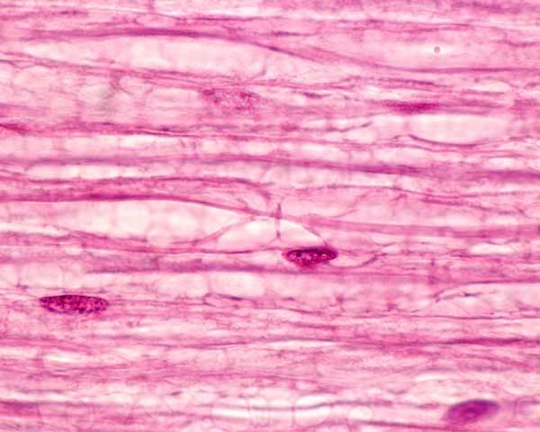 New Findings About Schwann Cells Have Implications for Treating Nerve Damage and Rethinking Cholesterol