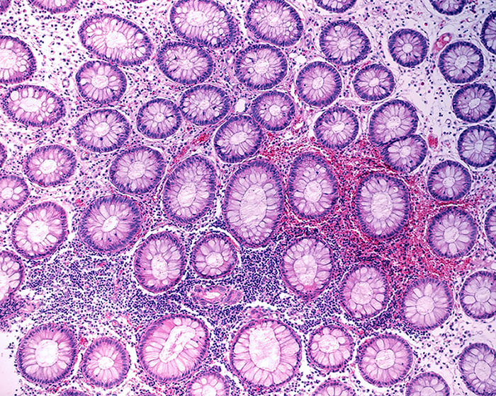 Animal Study Finds Age-Related Tryptophan Deficiency Increases Gut Dysbiosis and Systemic Inflammation