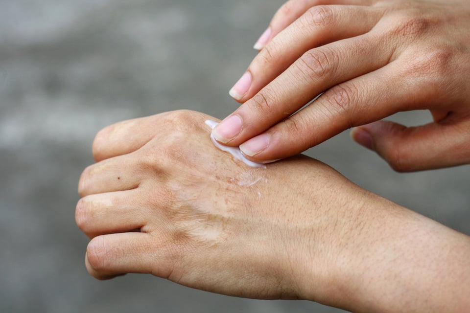 Topical Uses for Magnesium