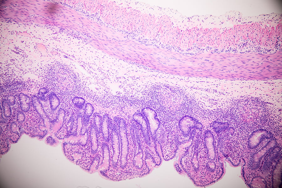 Bile Acids and Health: Beyond Fat Digestion