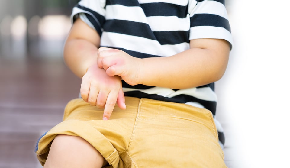 New Study Investigates the Association Between Vitamin D and Allergic Diseases in Children