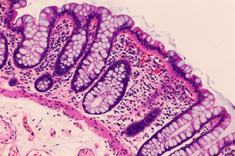Polyphenols May Support the Body’s Response to Increased Intestinal Permeability