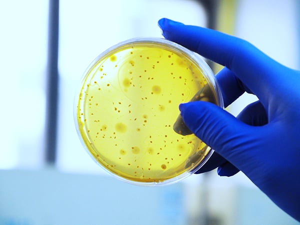 Selection Criteria for Probiotic Intervention