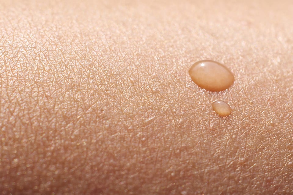 Vitamin A & Retinoids for Skin Health