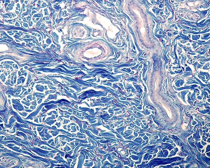 The Relationship Between Collagen and Cortisol