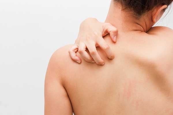 The Underappreciated Role of Elevated Insulin in Skin Disorders