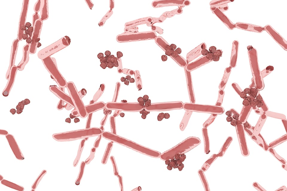Role of Probiotics and Resistant Starch for Healthy Aging