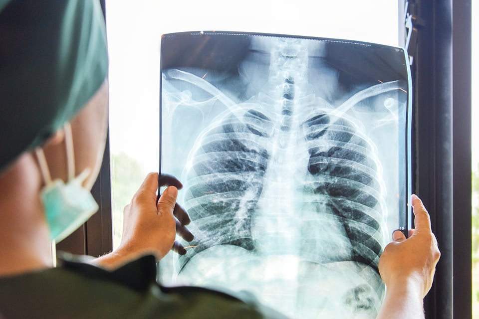 Dietary Selenium's Role in Acute Respiratory Syndrome