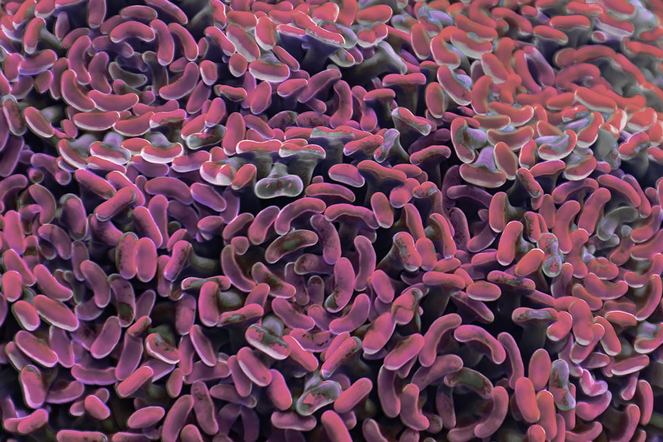 The Immunomodulating Effects of Lactobacillus Rhamnosus GG