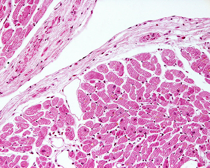 The Connection Between NAD+ and Heart Health