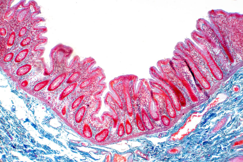 L-Glutamine: Promoting Gut Barrier Health