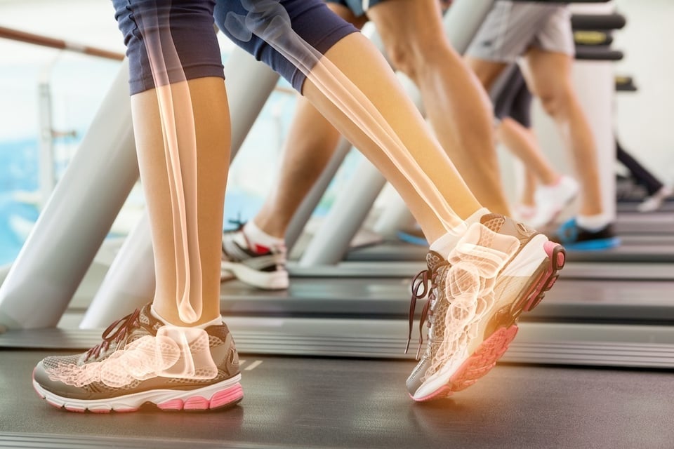 Meta-analysis Investigates Efficacy of Vitamin D Supplementation on Bone Health