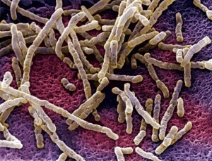 The bacterial gut biome may guide colon cancer progression.