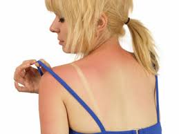 Nutrients for Sun-Damaged Skin