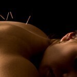 Can Acupuncture Help Cancer Patients?