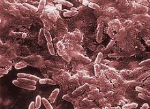 Viva la Commensal Biofilm