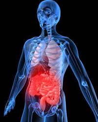 Ulcerative Colitis