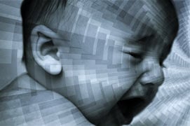 Autism and Cerebral Folate Deficiency