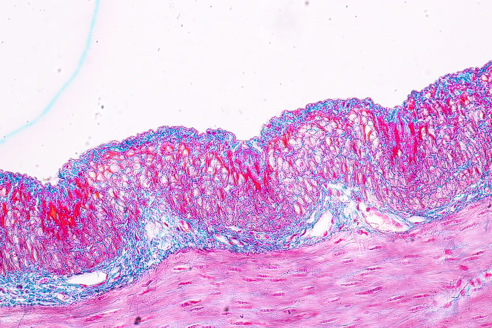 Deglycyrrhizinated Licorice (DGL) in Promoting Gastric Mucosal Health
