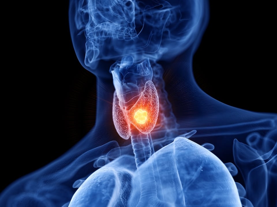 A Case Report on Trans-Geranylgeraniol Supplementation in a 27-Year-Old Male with Thyroid Dysfunction